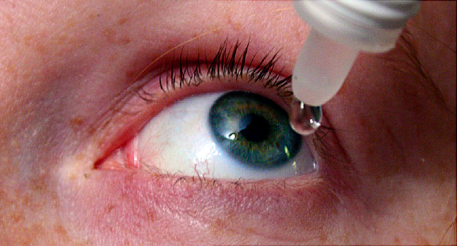 Dry Eyes downside – Signs, Causes, prevention and Therapy