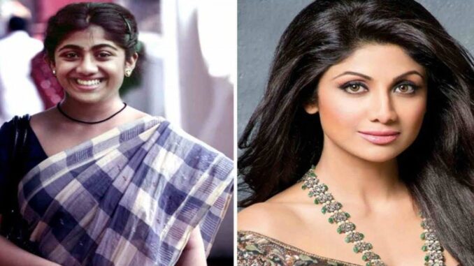 8 Bollywood Movie star Plastic Surgical procedure Earlier than And After
